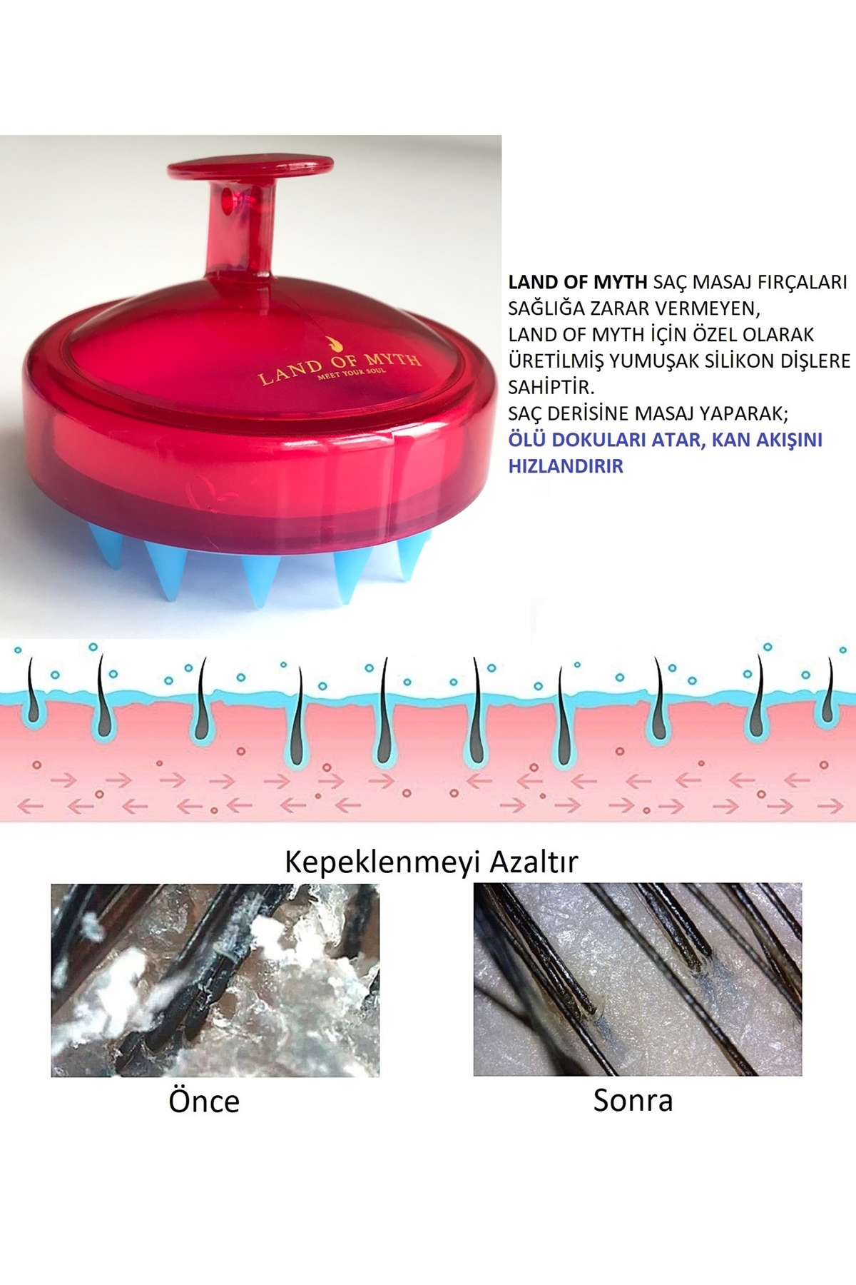 Yumuşak Silikon Dişli Saç Derisi Masaj Şampuan Duş Fırçası, Yetişkin, Çocuk - Evcil Hayvan Için (Kırmızı)