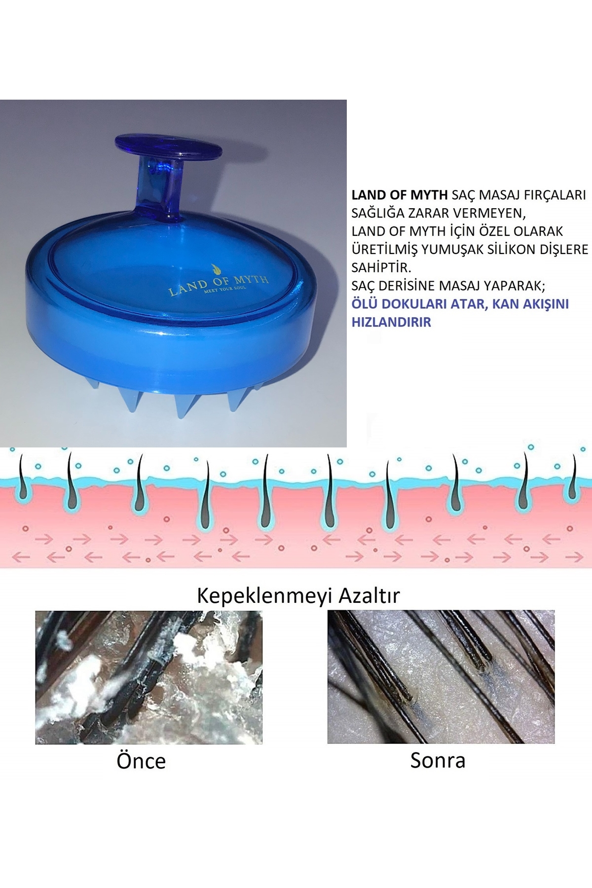 Yumuşak Silikon Dişli Saç Derisi Masaj Şampuan Duş Fırçası, Yetişkin, Çocuk - Evcil Hayvan Için (Mavi)